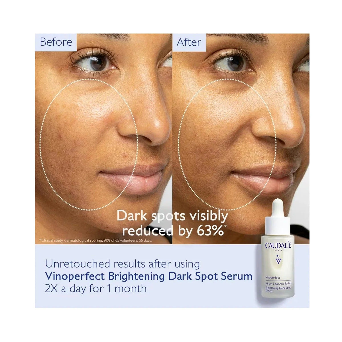 Caudalie Vinoperfect Brightening Dark Spot Serum – Radiance & Even Skin Tone
